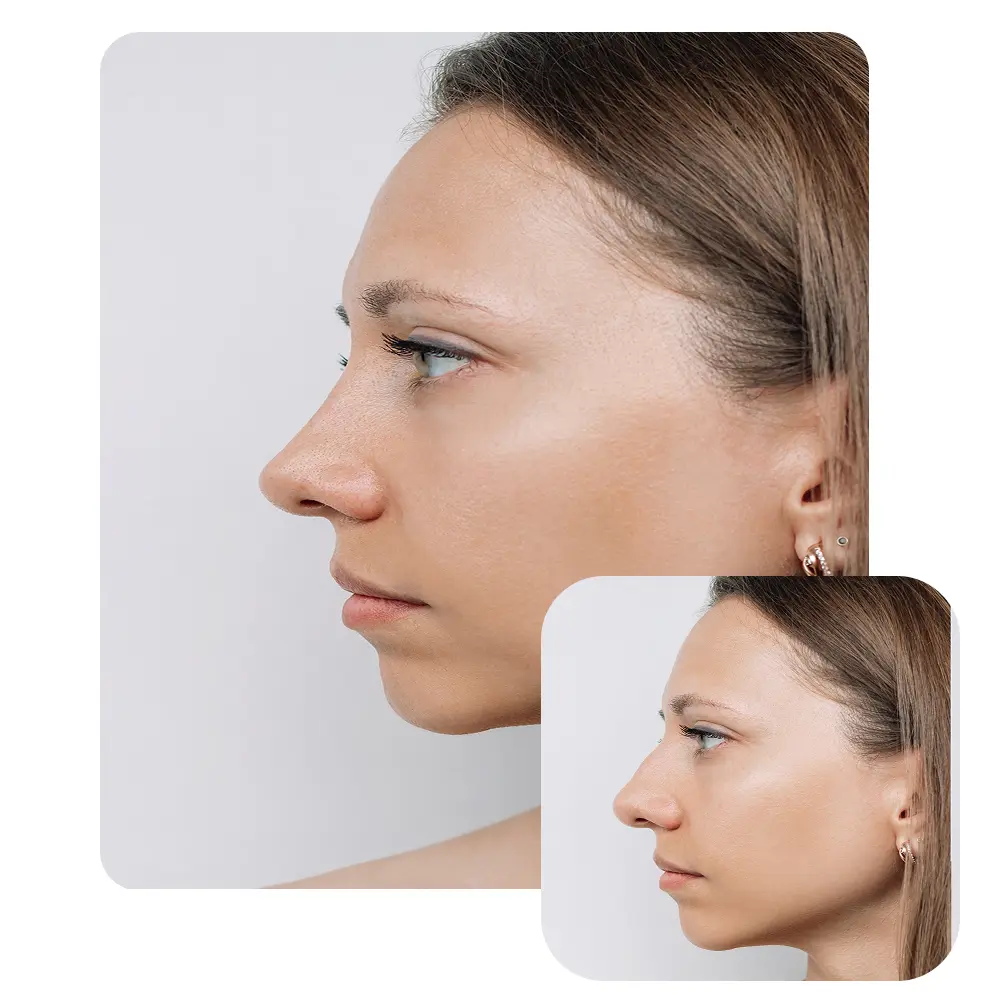 before-after-rhino-1