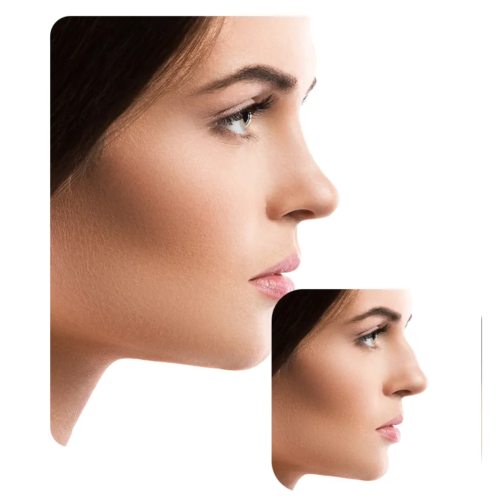 before-after-rhino-2